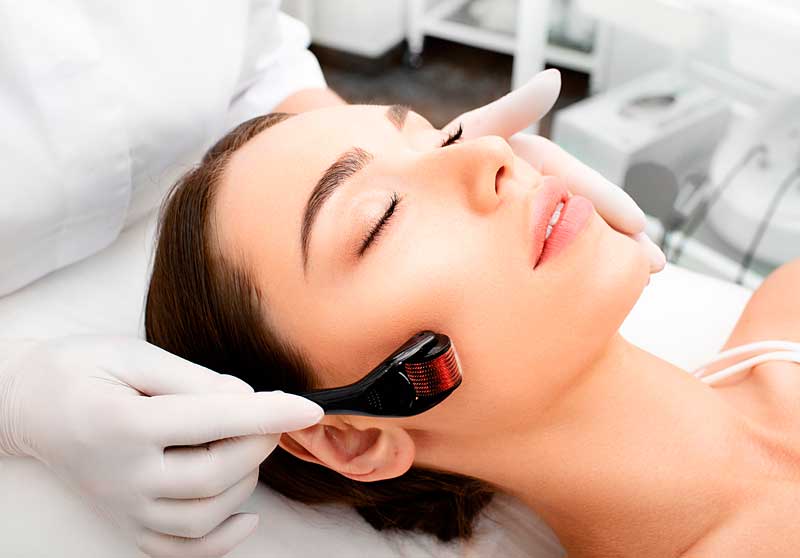 Estética Facial Microagulhamento com PRP – Clínica Belle Harmony